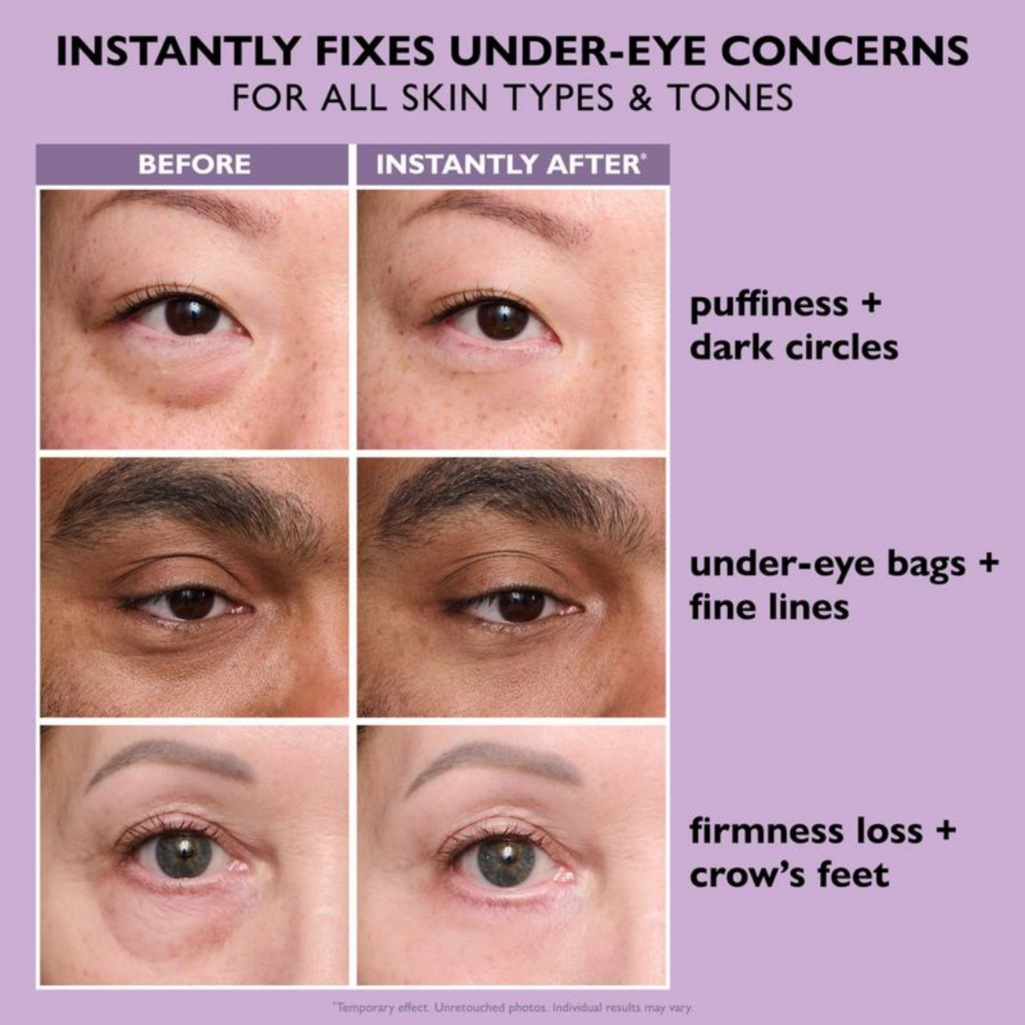 Liftr – Instant Under-Eye Tightener