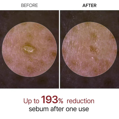 LumiRice - Glow Reset Ampoule