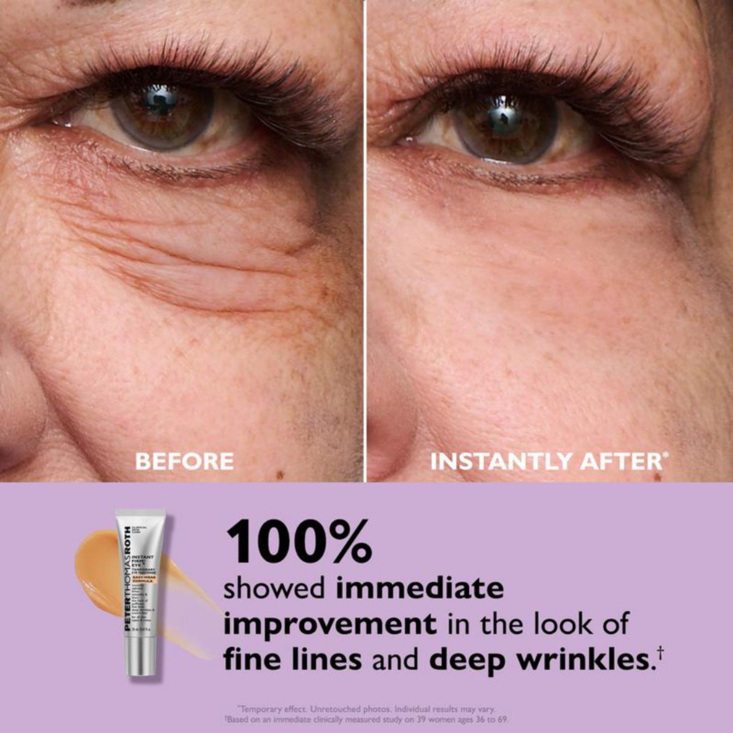 Liftr – Instant Under-Eye Tightener