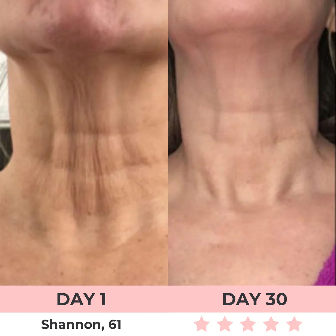 Luméva™ 7-in-1 Radiance Sculptor