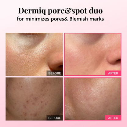 Dermiq Glow Duo – Pore & Spot Renewal Duo